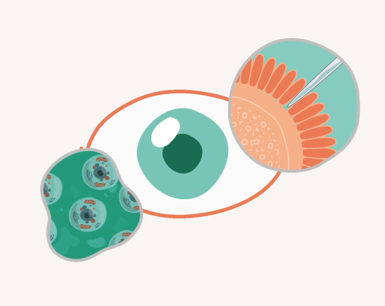 Inherited-Retinal-Disorders ASGCT Educational Video Retinal Disorder