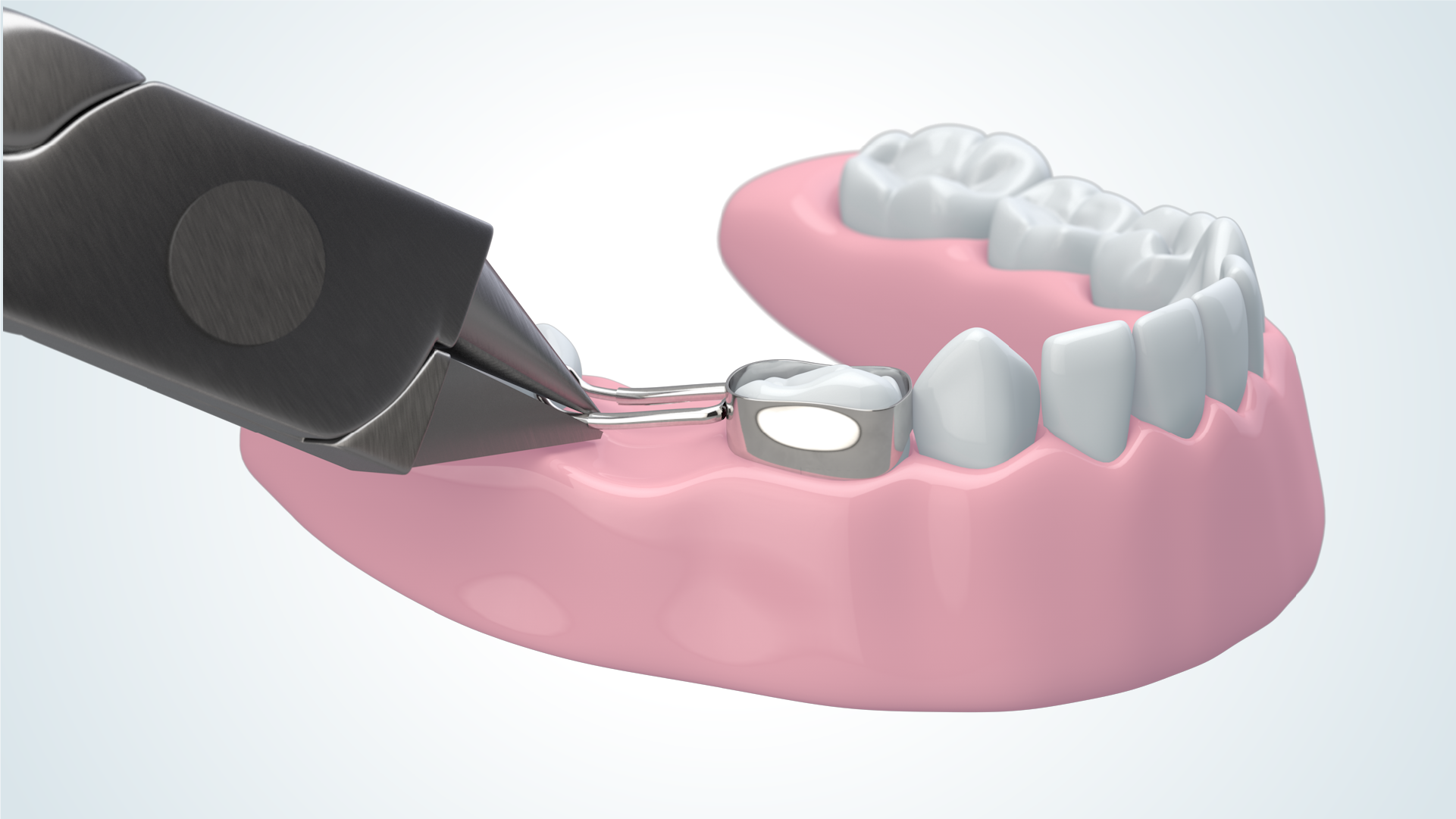 Oral Healthcare Video Production Company Screenshot Denovo Dental 3D Animated Product Video